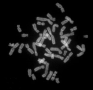 Datei:Chromosomen1.jpg